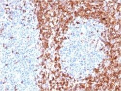 Bcl-2 Antibody (BCL2/6426R) - Azide and BSA Free, Novus Biologicals 100